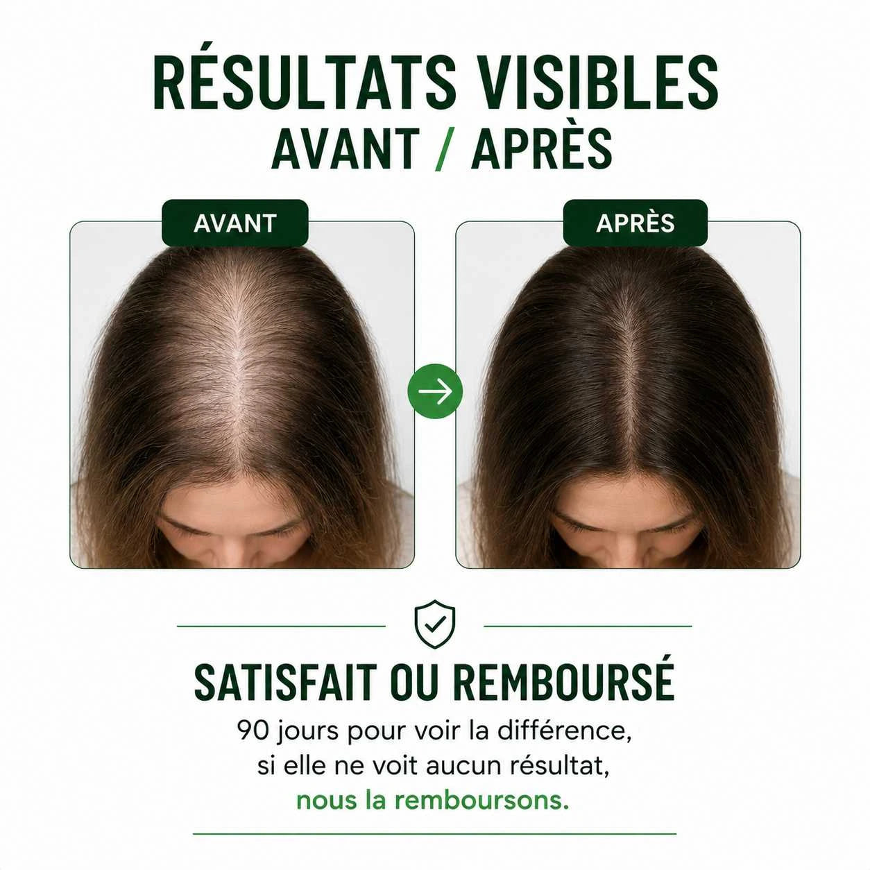 Gélules Anti-Chute · Stopper la chute des cheveux en 90 jours !